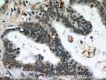 THRAP3 Antibody in Immunohistochemistry (Paraffin) (IHC (P))