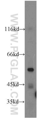 ARSK Antibody in Western Blot (WB)