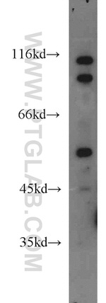 ARSK Antibody in Western Blot (WB)