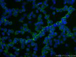OR4K17 Antibody in Immunocytochemistry (ICC/IF)
