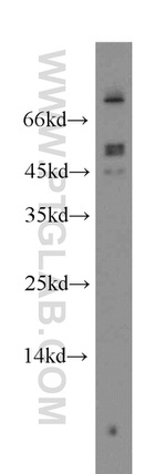 FOXJ3 Antibody in Western Blot (WB)