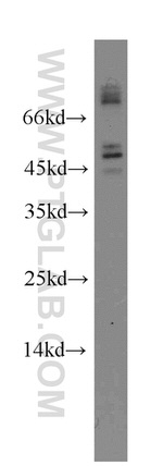 FOXJ3 Antibody in Western Blot (WB)