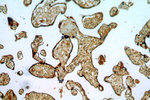 BTF3L3 Antibody in Immunohistochemistry (Paraffin) (IHC (P))