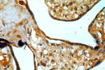 BTF3L3 Antibody in Immunohistochemistry (Paraffin) (IHC (P))