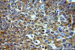 BTF3L3 Antibody in Immunohistochemistry (Paraffin) (IHC (P))