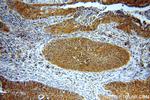 BTF3L3 Antibody in Immunohistochemistry (Paraffin) (IHC (P))
