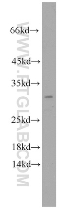 BTF3L3 Antibody in Western Blot (WB)