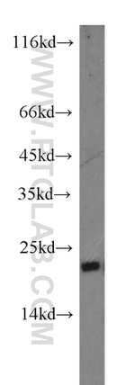 SFT2D3 Antibody in Western Blot (WB)