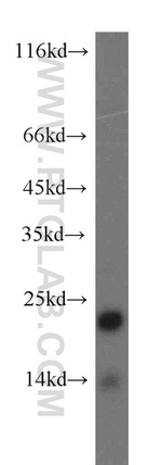 SFT2D3 Antibody in Western Blot (WB)