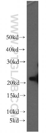 SFT2D3 Antibody in Western Blot (WB)