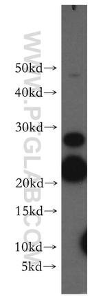 SFT2D3 Antibody in Western Blot (WB)