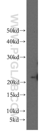SFT2D3 Antibody in Western Blot (WB)
