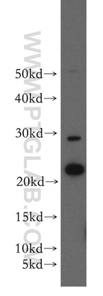 SFT2D3 Antibody in Western Blot (WB)