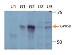 GPR50 Antibody in Western Blot (WB)