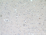 RYR2 Antibody in Immunohistochemistry (Paraffin) (IHC (P))