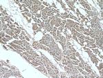 RYR2 Antibody in Immunohistochemistry (Paraffin) (IHC (P))