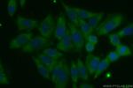 PARP4 Antibody in Immunocytochemistry (ICC/IF)
