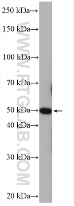 ADRA1A Antibody in Western Blot (WB)