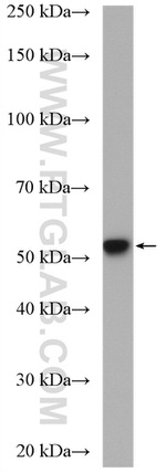 ADRA1A Antibody in Western Blot (WB)