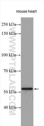 ADRA1A Antibody in Western Blot (WB)