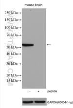 ADRA1A Antibody in Western Blot (WB)