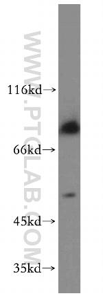 ADRA1A Antibody in Western Blot (WB)