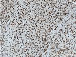 ADRA2B Antibody in Immunohistochemistry (Paraffin) (IHC (P))