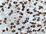 ADRA2B Antibody in Immunohistochemistry (Paraffin) (IHC (P))
