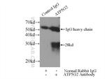 ATP5G2 Antibody in Immunoprecipitation (IP)