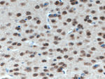 ATP7B Antibody in Immunohistochemistry (Paraffin) (IHC (P))