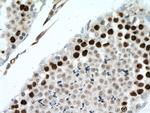 ATR Antibody in Immunohistochemistry (Paraffin) (IHC (P))