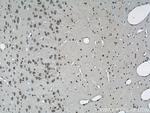 BRCA2 Antibody in Immunohistochemistry (Paraffin) (IHC (P))