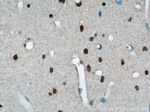 BRCA2 Antibody in Immunohistochemistry (Paraffin) (IHC (P))