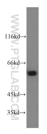 CCT6A Antibody in Western Blot (WB)