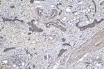 COL6A3 Antibody in Immunohistochemistry (Paraffin) (IHC (P))