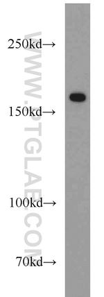 Collagen Type XVI Antibody in Western Blot (WB)