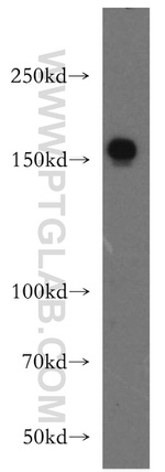 Collagen Type XVI Antibody in Western Blot (WB)