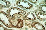 THUMPD3 Antibody in Immunohistochemistry (Paraffin) (IHC (P))