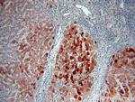 THUMPD3 Antibody in Immunohistochemistry (Paraffin) (IHC (P))
