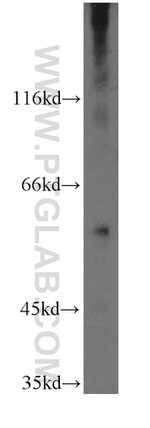 THUMPD3 Antibody in Western Blot (WB)