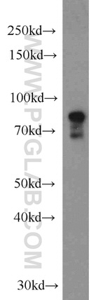 DHX32 Antibody in Western Blot (WB)