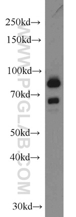 DHX32 Antibody in Western Blot (WB)