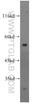 ZBTB37 Antibody in Western Blot (WB)