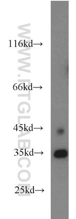 NUP53 Antibody in Western Blot (WB)