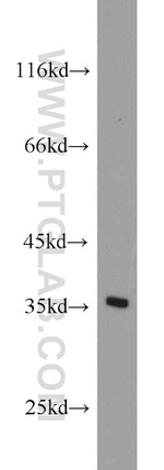 NUP53 Antibody in Western Blot (WB)