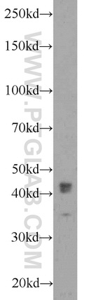 NUP53 Antibody in Western Blot (WB)