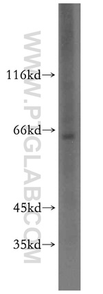 TM7SF3 Antibody in Western Blot (WB)