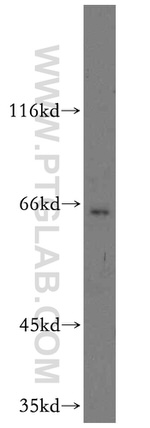 TM7SF3 Antibody in Western Blot (WB)
