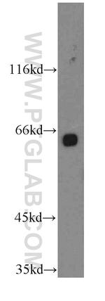 TM7SF3 Antibody in Western Blot (WB)
