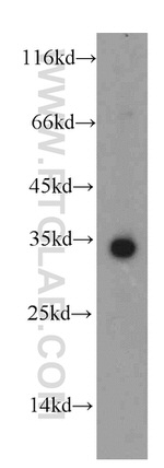 HADH Antibody in Western Blot (WB)